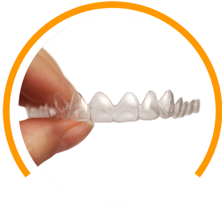 Invisalign Process